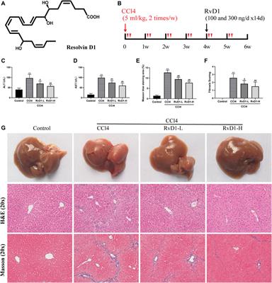 Frontiers | Resolvin D1 Attenuates CCl4 Induced Liver Fibrosis By ...